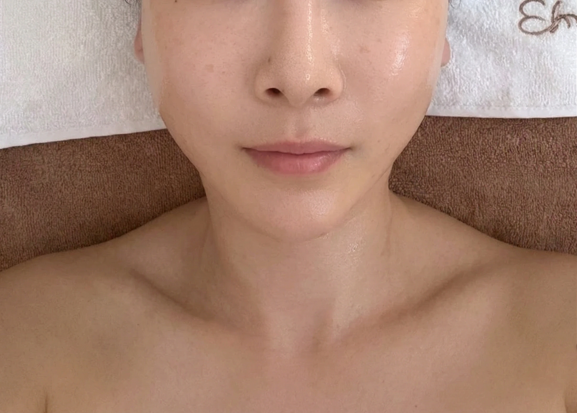 정면 after 사진