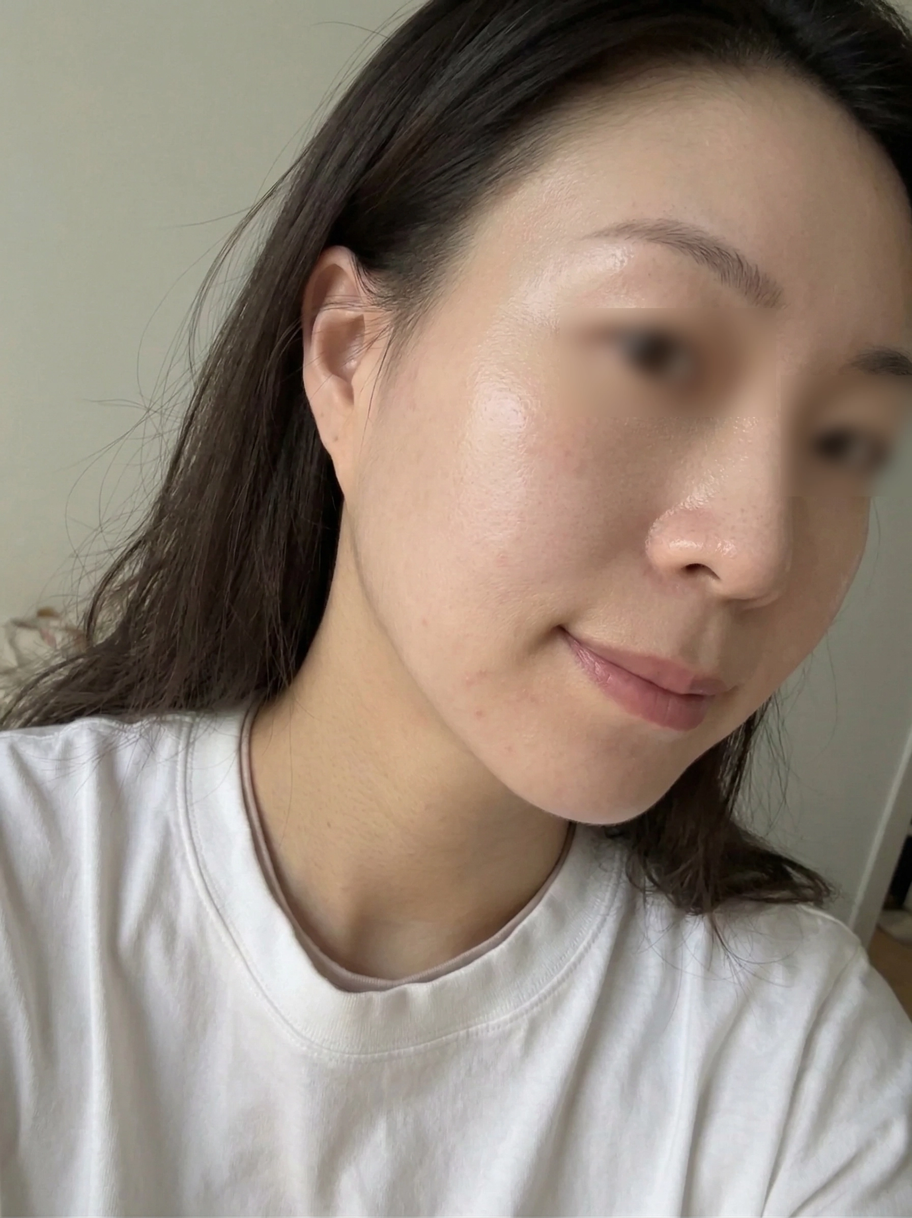 피부결 after 사진